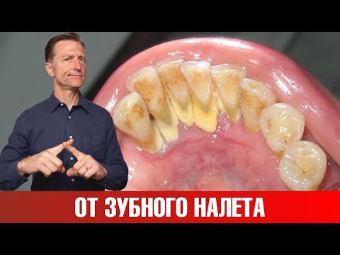 Как очистить зубы от зубного камня в домашних условиях