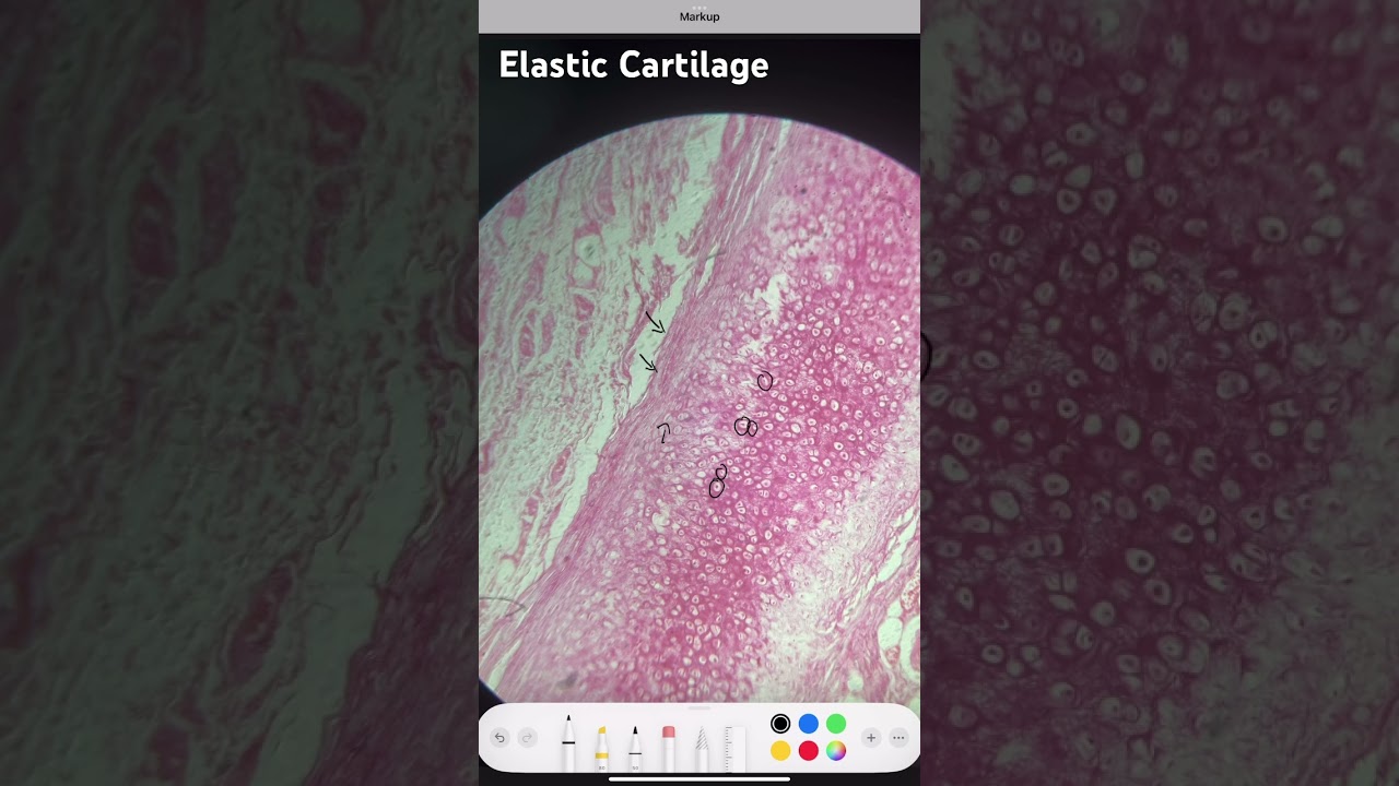 Эластичный хрящ