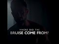 Where'd the Bruise come from?