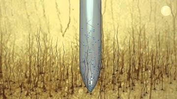 Nanoparticles embedded in matrix