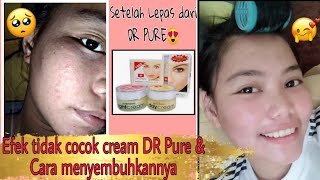 (Review) reaksi tidak cocok DR PURE & cara mengatasinya😍| dapat sembuhnya dan dapat juga glowingnya