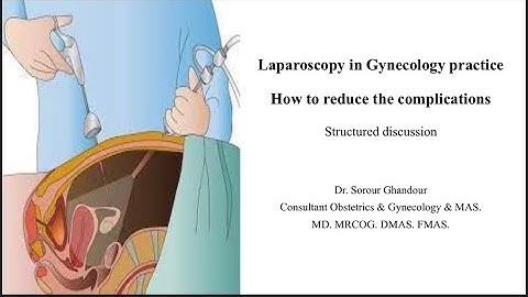 MRCOG part 3 stations - Laparoscopy in Gynecology practice How to reduce the complications -