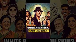 White patches (safed daag) ka real reason 😳and treatment.🌟