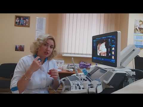 Определение пола плода на УЗИ.  Inside Pregnancy: Girl or Boy? Baby Ultrasound and Gender Reveal