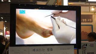 독일식발관리 푸스플레게(Fusspflege) 발전문 브랜드 레푸스(Refuss)