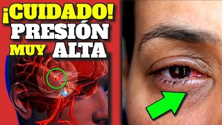 GO DOWN! BLOOD PRESSURE WITHOUT MEDICATION IS POSSIBLE!| ALL about ARTERIAL HYPERTENSION