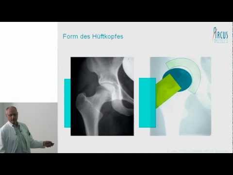 Video 1 ARCUS Sportklinik