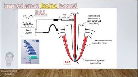 Principles of Apex Locators