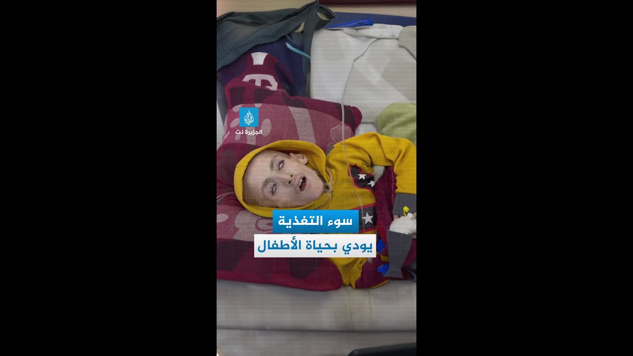 أمهات وأطباء يروون قصص الجوع الشديد في غزة المحاصرة