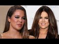 Khloe Kardashian Confirms She’s Had a NOSE JOB