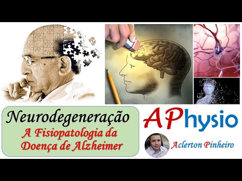 Vídeo: Qual é uma alteração fisiopatológica consistente com a doença de Alzheimer?