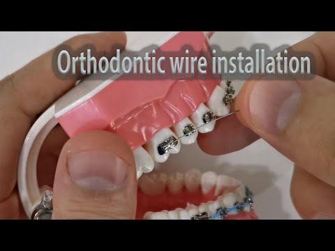 How to install