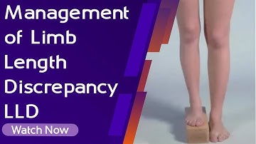 Management of Limb Length Discrepancy LLD | Orthopaedic Academy