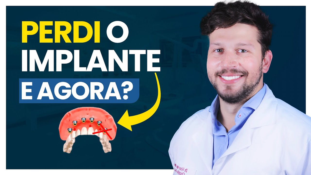 O Implante Dentário CAIU e Agora o que Fazer? - YouTube