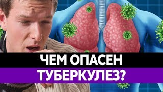 ТУБЕРКУЛЕЗ ЛЕГКИХ. Чем опасен? Как заражаются? Симптомы и смертность!