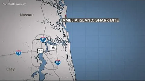 16-year-old girl reportedly bitten by shark in Ame...