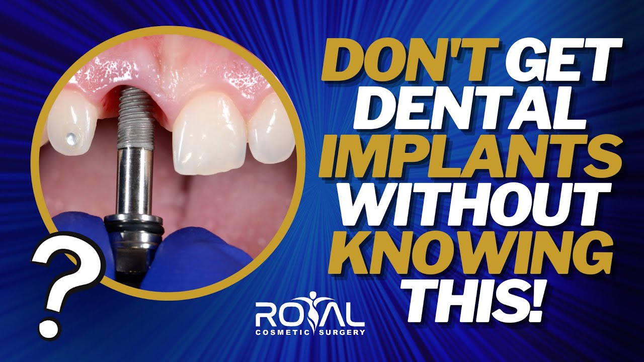 Dental Implant in Islamabad Royal Dental Associates Islamabad YouTube