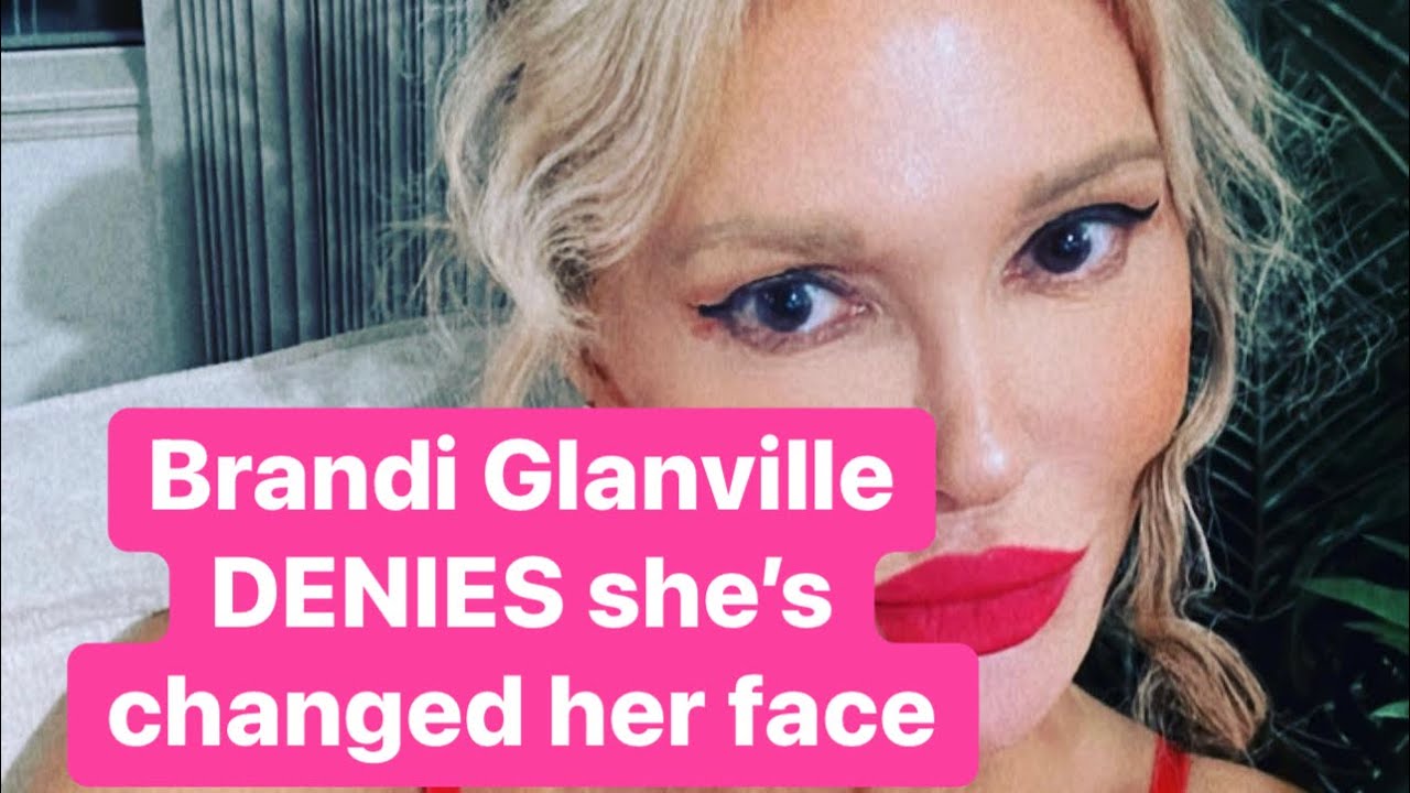 Brandi Glanville responds to the plastic surgery rumors YouTube