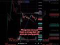 What you say guys #stockmarket #trading #trading #nifty #morningtrading