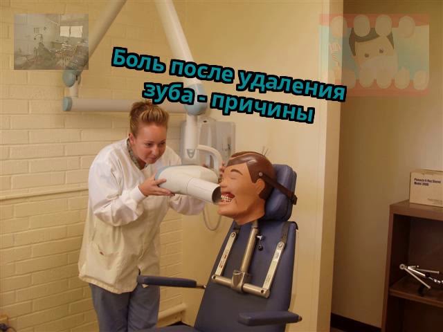 Боль после удаления зуба - причины