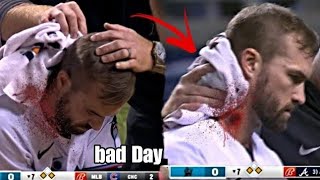 MLB• Scary lnjuries Part2