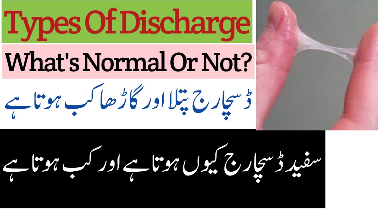 White Discharge In Women White Discharge Kyu Hota Hi White