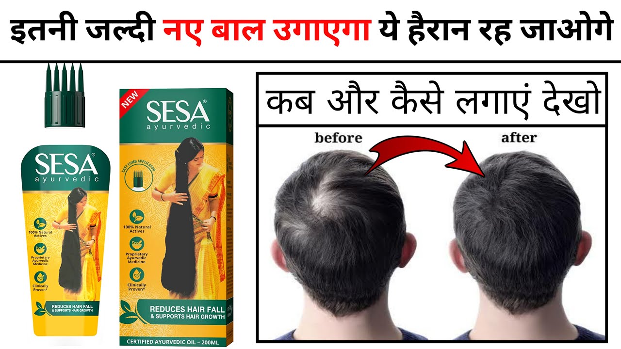 Sesa Hair Oil Review sesa hair oil results how to use sesa hair oil YouTube