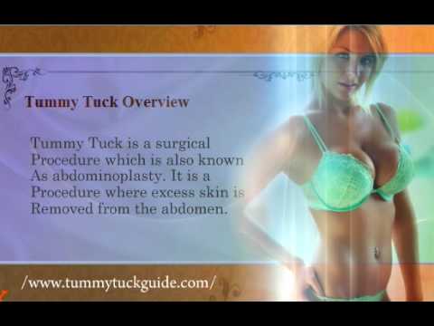 Tummy Tuck # 5
