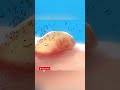 Nie rób TEGO z pęcherzem po oparzeniu! 😱🔥 #shorts #zdrowie #viral