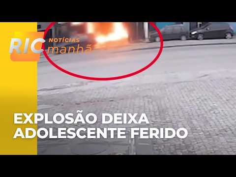 Gallon explosion leaves teenager seriously injured in Paranaguá