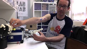 Bionico project : tests with inMoov hand + muscle sensors + arduino
