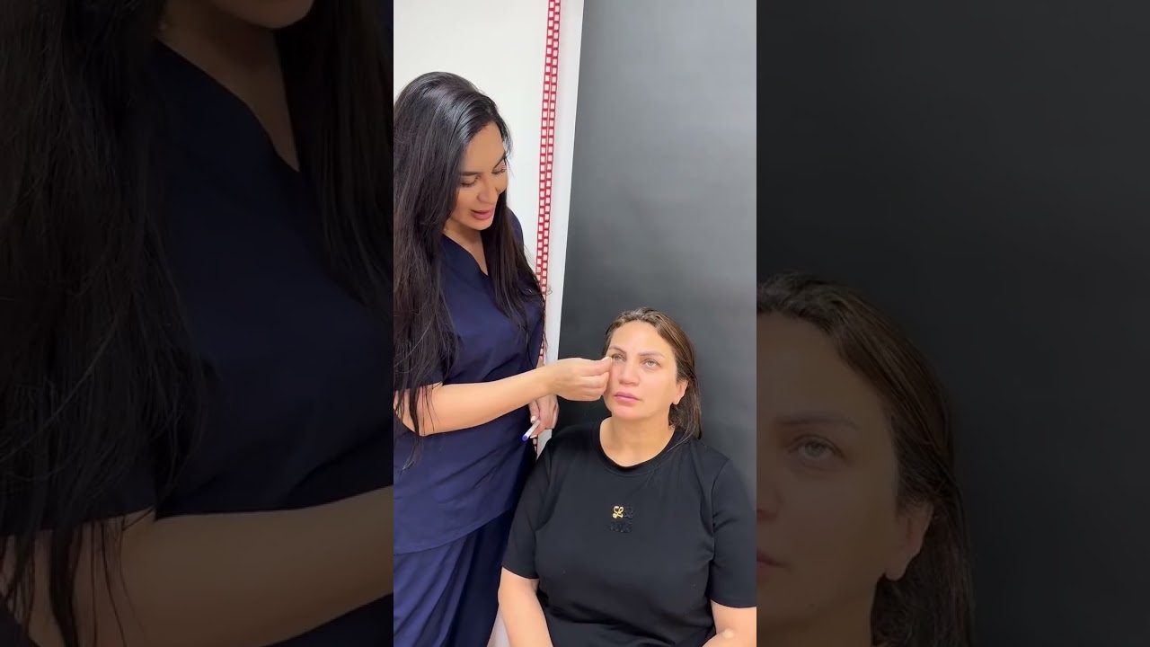 Video Önizləmə