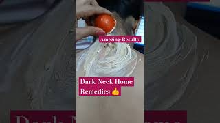 Black Dark Neck Home Remedies??shorts ytshorts youtubshorts sanakhan