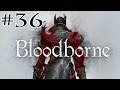 Bloodborne Millbee Plays Part {Resident