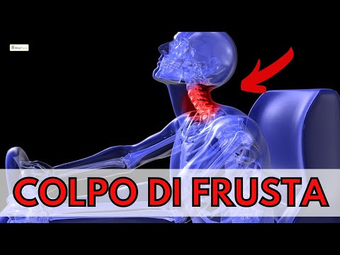 Video: Cosa significa colpo di frusta?