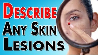 Describing Skin Lesions
