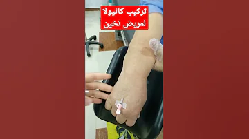 تركيب كانيولا لمريض سمين واوردته ضعيفه 