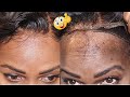 How to Remove A Lace Frontal Wig Quickly &amp; Easily In 5 Mins | Sis!! Save Your Edges From Falling Out