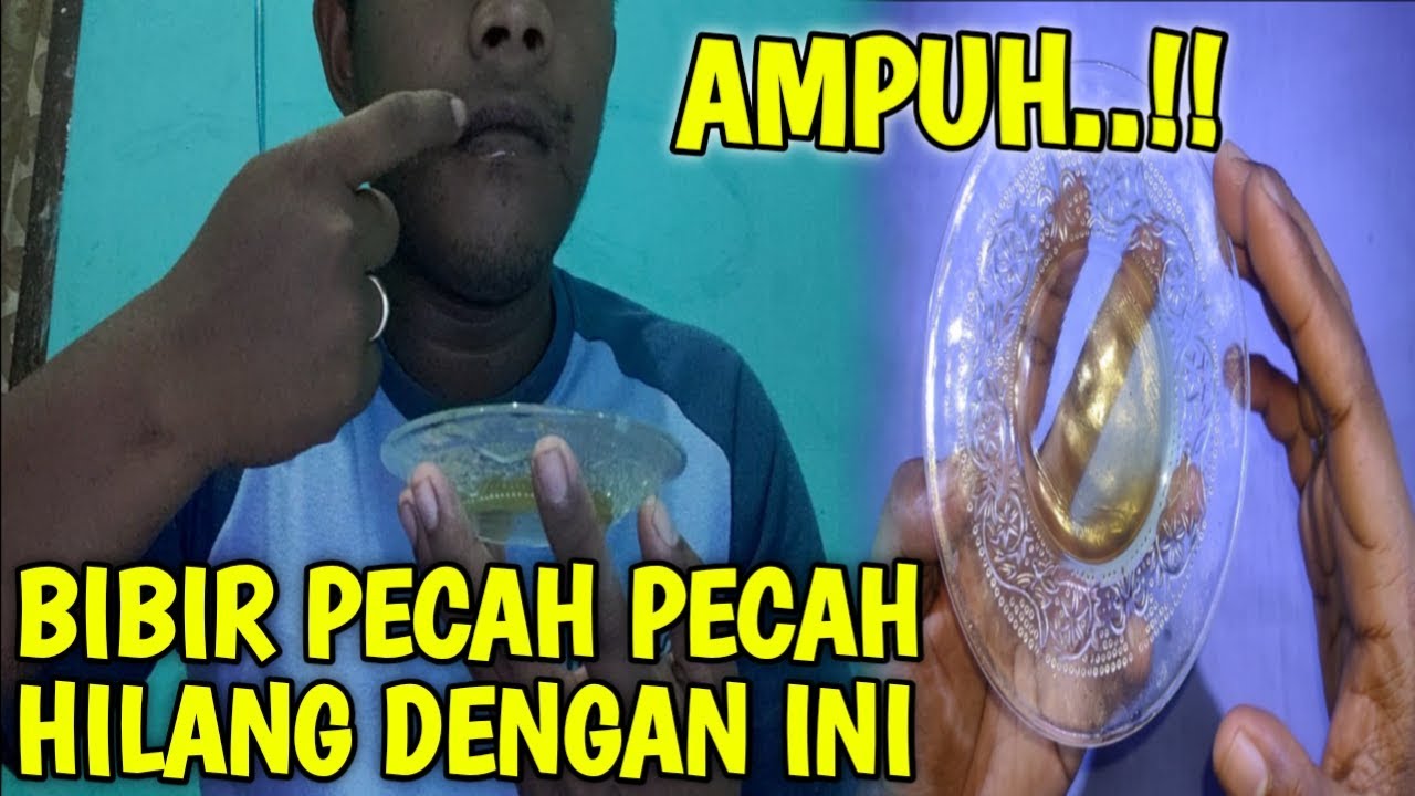 Oleskan ini!! Bibir pecah pecah hilang seketika || Cara mengatasi bibir