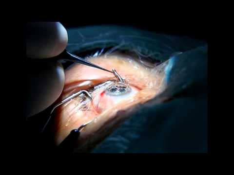 Vídeo: Microcefalia Lagrimal Con Pezuñas. Donde La Evolución Conducirá Al Hombre - Vista Alternativa