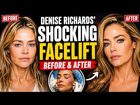 Exposed Uncensored Denise Richards Like Youve Never Seen Vault - mj1ucx7