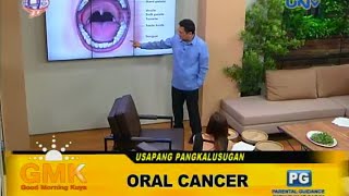 Oral Cancer: Causes, Symptoms and Treatment