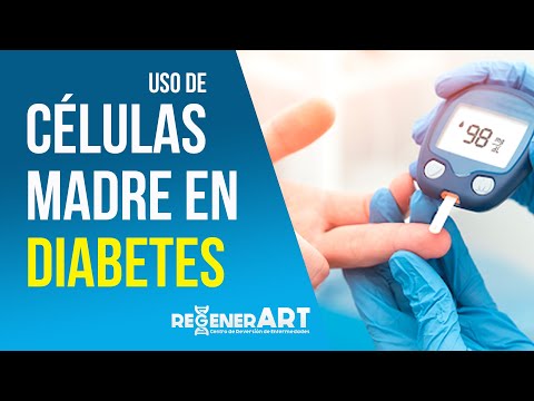 diabetes tipo 2 tratamientos con células madre