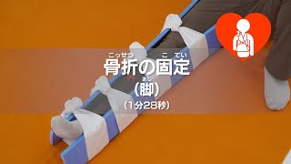 骨折の固定（脚）