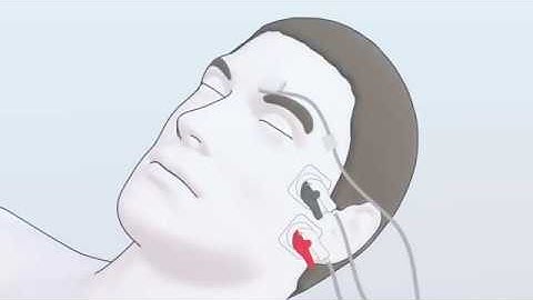 How to set up the ToFscan Eyebrow Sensor