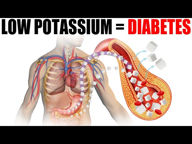 Potassium Deficiency Causes Diabetes class=