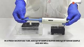 SERUM PROTEIN ELECTROPHORESIS TEACHING KIT