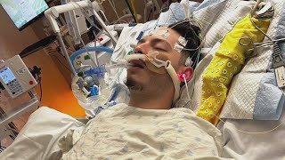 'He has brain trauma' | San Antonio cyclist on life support after riding to work