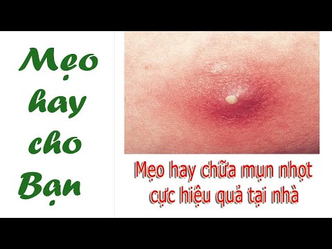 Cách trị mụn nhọt ở nách như thế nào cho đúng