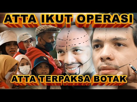 ATTA terpaksa BOTAK. Karna Operasi juga